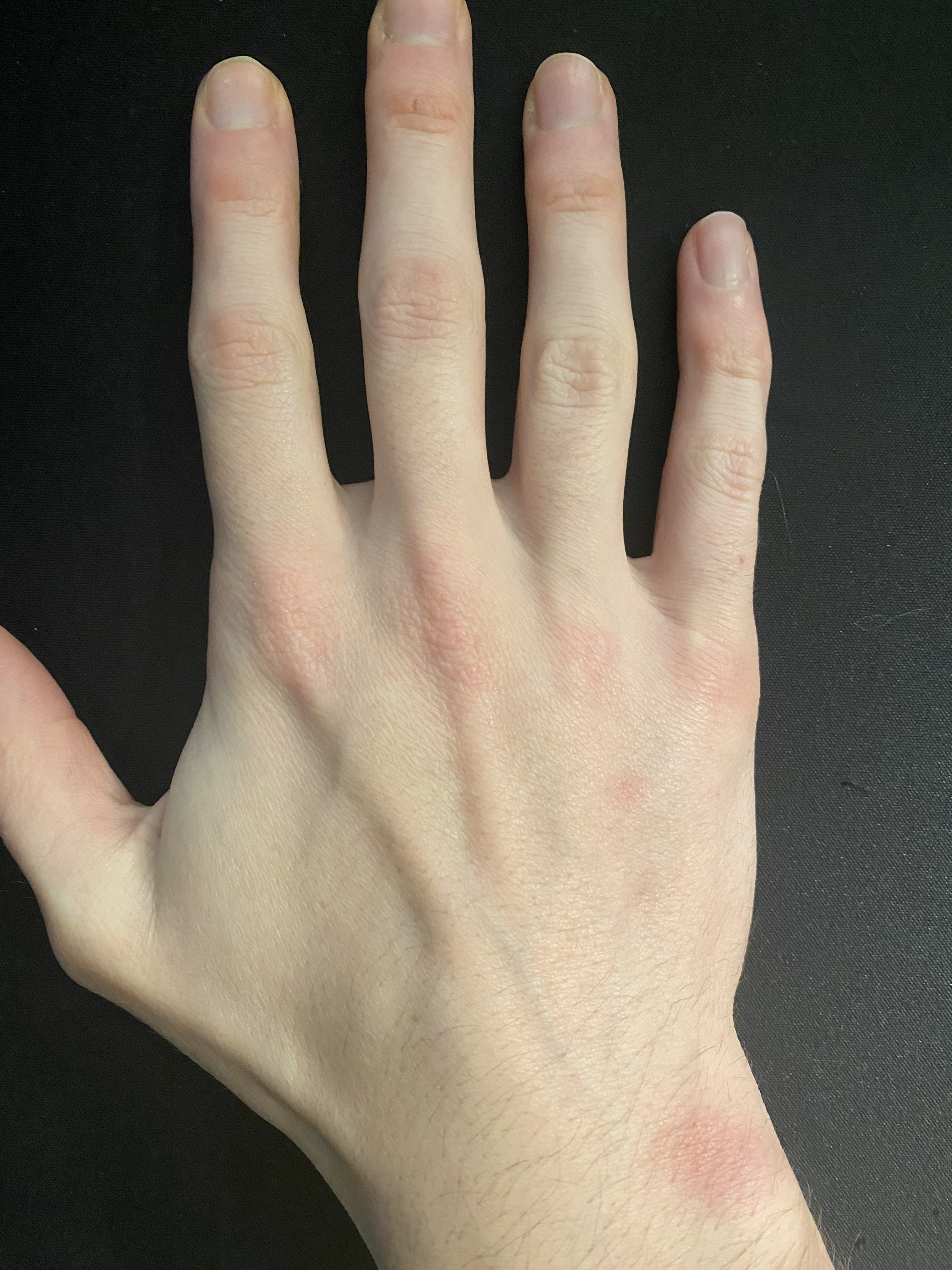 Figure 2: Right hand